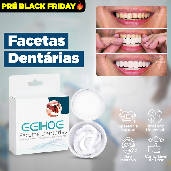 Facetas Dentárias Naturais Removíveis - Ultimo dia da Promoção